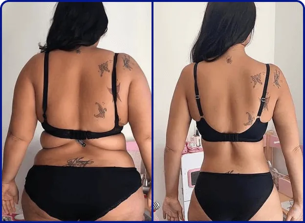 Comparaison avant et après montrant la transformation corporelle d'une cliente avec Proper Keto.